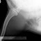 Schulter / shoulder