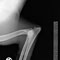 Ellbogen / elbows
