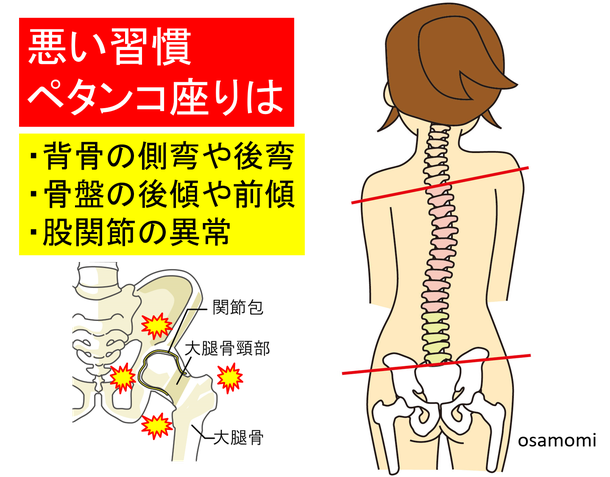 正しい座り方を学ぶ。昭島市のオサモミ整体院。ペタンコ座り・側弯・股関節痛い