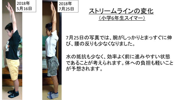 肩関節の痛み 姿勢 肩甲骨 肩甲骨痛み 背中の痛み 野球肩の原因 野球肩原因 野球肩治し方 野球肩体操 野球肩ストレッチ 野球 野球肩 肩が痛い ピッチャー リトルリーガーズショルダー 腱板損傷 投球傷害 水泳 競泳 腰痛 分離症 分離すべり症 水泳肩スイマーズショルダー 水泳肩 スイマーズショルダー治療 スイマーズショルダー治るのか 岐阜 岐阜市 岐阜市茜部 岐阜市東鶉 岐阜市南鶉 岐阜市中鶉 岐阜市柳津町 羽島市 羽島郡 笠松町 岐南町 茜部 鶉 東鶉 中鶉 南鶉 柳津 笠松