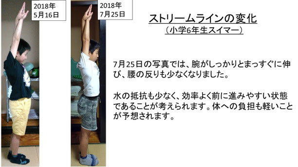 肩関節の痛み 姿勢 肩甲骨 肩甲骨痛み 背中の痛み 野球肩の原因 野球肩原因 野球肩治し方 野球肩体操 野球肩ストレッチ 野球 野球肩 肩が痛い ピッチャー リトルリーガーズショルダー 腱板損傷 投球傷害 水泳 競泳 腰痛 分離症 分離すべり症 水泳肩スイマーズショルダー 水泳肩 スイマーズショルダー治療 スイマーズショルダー治るのか 岐阜 岐阜市 岐阜市茜部 岐阜市東鶉 岐阜市南鶉 岐阜市中鶉 岐阜市柳津町 羽島市 羽島郡 笠松町 岐南町 茜部 鶉 東鶉 中鶉 南鶉 柳津 笠松