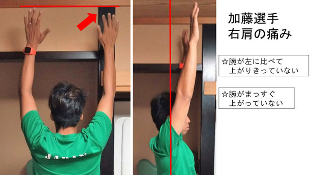 肩関節の痛み　姿勢　肩甲骨　肩甲骨痛み　背中の痛み　野球肩の原因　野球肩原因　野球肩治し方　野球肩体操　野球肩ストレッチ　野球　野球肩　肩が痛い　ピッチャー　リトルリーガーズショルダー　腱板損傷　投球傷害　水泳　競泳　腰痛　分離症　分離すべり症　水泳肩スイマーズショルダー　水泳肩　スイマーズショルダー治療　スイマーズショルダー治るのか　岐阜　岐阜市　岐阜市茜部　岐阜市東鶉　岐阜市南鶉　岐阜市中鶉　岐阜市柳津町　羽島市　羽島郡　笠松町　岐南町　茜部　鶉　東鶉　中鶉　南鶉　柳津　笠松　