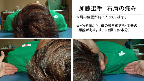 肩関節の痛み　姿勢　肩甲骨　肩甲骨痛み　背中の痛み　野球肩の原因　野球肩原因　野球肩治し方　野球肩体操　野球肩ストレッチ　野球　野球肩　肩が痛い　ピッチャー　リトルリーガーズショルダー　腱板損傷　投球傷害　水泳　競泳　腰痛　分離症　分離すべり症　水泳肩スイマーズショルダー　水泳肩　スイマーズショルダー治療　スイマーズショルダー治るのか　岐阜　岐阜市　岐阜市茜部　岐阜市東鶉　岐阜市南鶉　岐阜市中鶉　岐阜市柳津町　羽島市　羽島郡　笠松町　岐南町　茜部　鶉　東鶉　中鶉　南鶉　柳津　笠松　