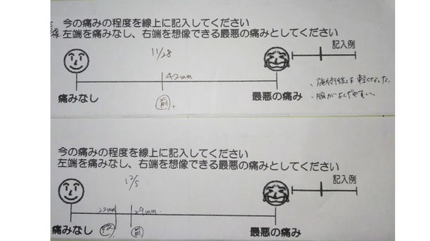 肩関節の痛み 姿勢 肩甲骨 肩甲骨痛み 背中の痛み 野球肩の原因 野球肩原因 野球肩治し方 野球肩体操 野球肩筋トレ 野球肩病院 ストレッチ 野球 野球肩 肩が痛い ピッチャー リトルリーガーズショルダー 腱板損傷 投球傷害 水泳 競泳 腰痛 分離症 分離すべり症 水泳肩スイマーズショルダー 水泳肩 スイマーズショルダー治療 スイマーズショルダー治るのか 岐阜 岐阜市 岐阜市茜部 岐阜市東鶉 岐阜市南鶉 岐阜市中鶉 岐阜市柳津町 羽島市 羽島郡 笠松町 岐南町 茜部 鶉 東鶉 中鶉 南鶉 柳津 笠松