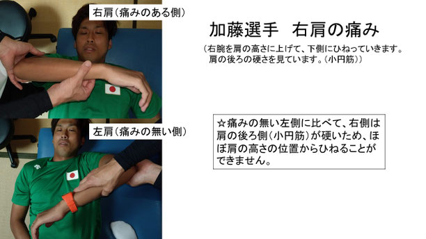 肩関節の痛み　姿勢　肩甲骨　肩甲骨痛み　背中の痛み　野球肩の原因　野球肩原因　野球肩治し方　野球肩体操　野球肩ストレッチ　野球　野球肩　肩が痛い　ピッチャー　リトルリーガーズショルダー　腱板損傷　投球傷害　水泳　競泳　腰痛　分離症　分離すべり症　水泳肩スイマーズショルダー　水泳肩　スイマーズショルダー治療　スイマーズショルダー治るのか　岐阜　岐阜市　岐阜市茜部　岐阜市東鶉　岐阜市南鶉　岐阜市中鶉　岐阜市柳津町　羽島市　羽島郡　笠松町　岐南町　茜部　鶉　東鶉　中鶉　南鶉　柳津　笠松　