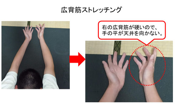肩関節の痛み 姿勢 肩甲骨 肩甲骨痛み 背中の痛み 野球肩の原因 野球肩原因 野球肩治し方 野球肩体操 野球肩ストレッチ 野球 野球肩 肩が痛い ピッチャー リトルリーガーズショルダー 腱板損傷 投球傷害 水泳 競泳 腰痛 分離症 分離すべり症 水泳肩スイマーズショルダー 水泳肩 スイマーズショルダー治療 スイマーズショルダー治るのか 岐阜 岐阜市 岐阜市茜部 岐阜市東鶉 岐阜市南鶉 岐阜市中鶉 岐阜市柳津町 羽島市 羽島郡 笠松町 岐南町 茜部 鶉 東鶉 中鶉 南鶉 柳津 笠松