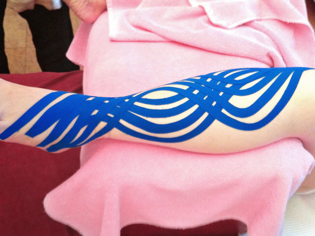 Unterschenkel mit verschlungenem blauem Kinesiotape