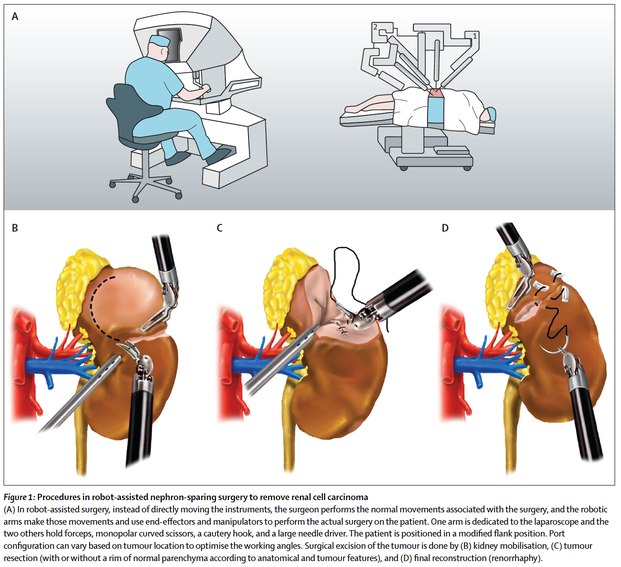 http://www.thelancet.com/journals/lancet/article/PIIS0140-6736(15)00046-X/abstract