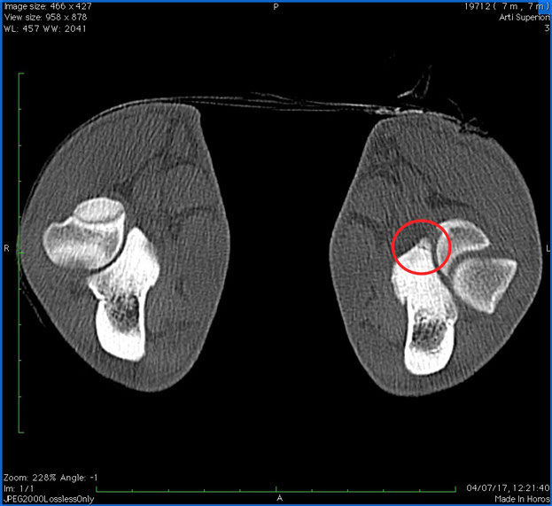 CT Aufnahme einer Ellbogendysplasie - Vetclinic Bozen 