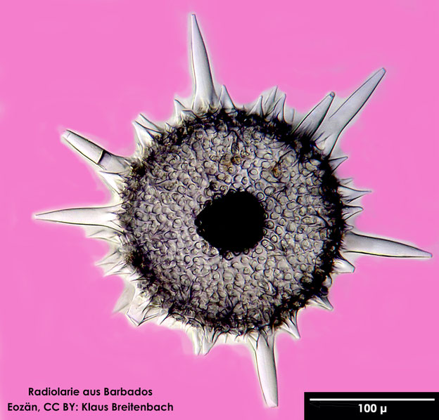 Radiolarie, Radiolarien, Senckenberg, fossil, Eozän, Barbados