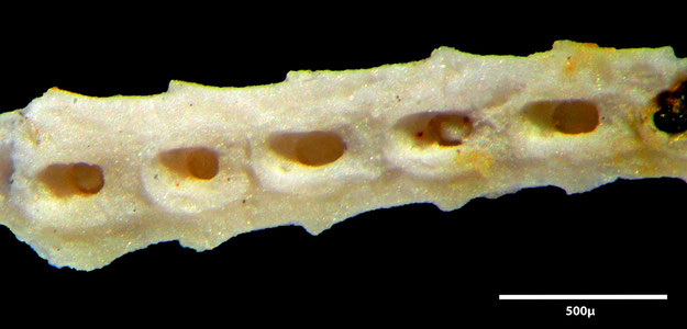 Senckenberg, Bryozoa, Bryozoen, Moostierchen, Sammlung Voigt