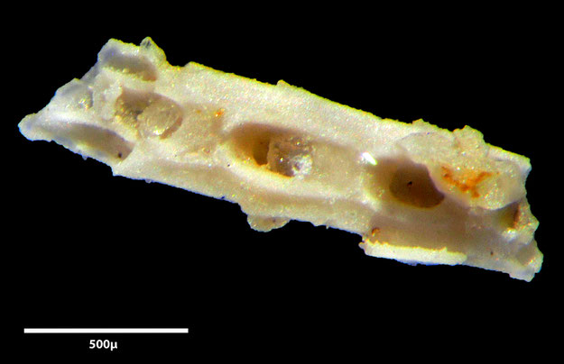 Senckenberg, Bryozoa, Bryozoen, Moostierchen, Sammlung Voigt
