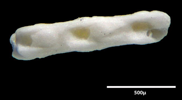Senckenberg, Bryozoa, Bryozoen, Moostierchen, Sammlung Voigt