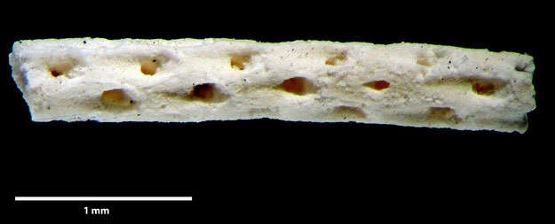 Senckenberg, Bryozoa, Bryozoen, Moostierchen, Sammlung Voigt