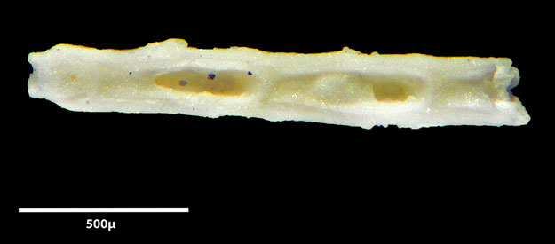 Senckenberg, Bryozoa, Bryozoen, Moostierchen, Sammlung Voigt