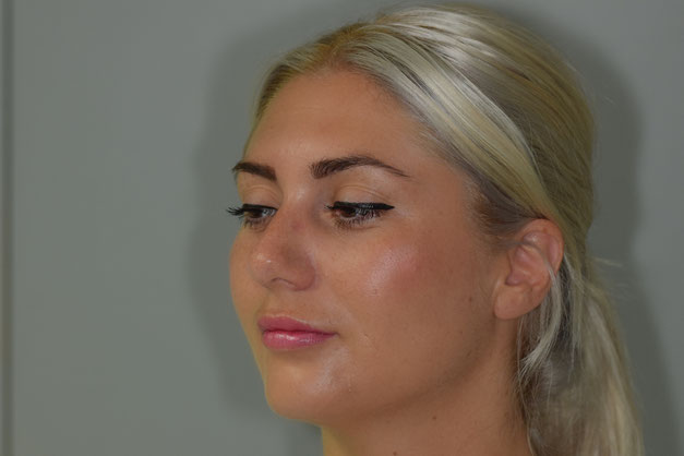 Acide hyaluronique Tours, belotero lips