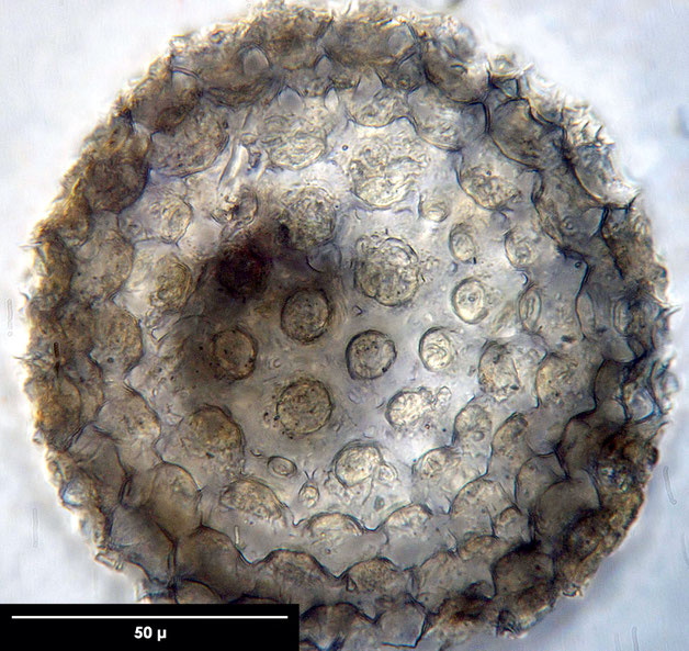 Radiolarie, Radiolarien, Senckenberg, fossil, Eozän, Barbados 