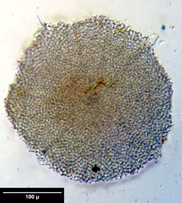 Radiolarie, Radiolarien, Senckenberg, fossil, Eozän, Barbados 
