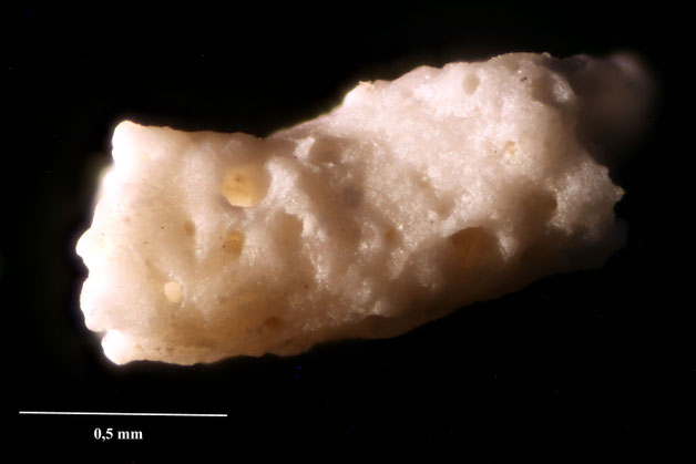 Senckenberg, Bryozoa, Bryozoen, Moostierchen, Sammlung Voigt