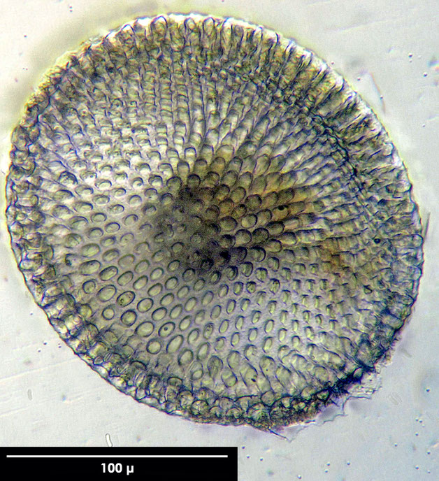 Radiolarie, Radiolarien, Senckenberg, fossil, Eozän, Barbados 
