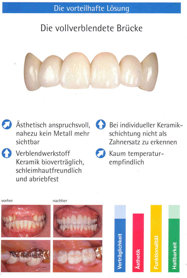 vollverblendete Brücke