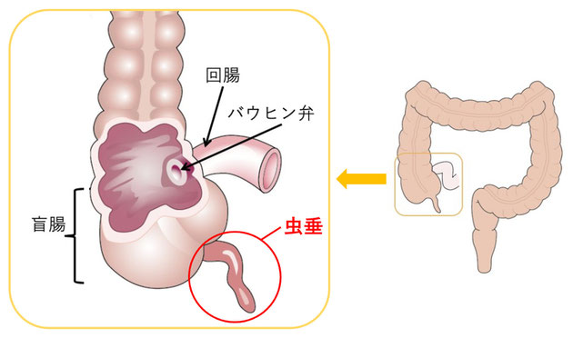 急性虫垂炎 茨木市の小児科 はら小児科クリニック