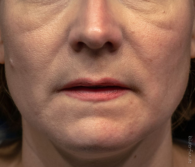 Die linke Bildhälfte mit der MÀDARA CC Cream, die rechte Bildhälfte ohne.