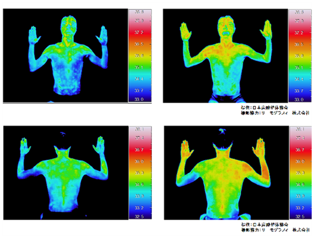 炭酸による整体で体温上昇、冷え性、むくみ、こむら返り解消