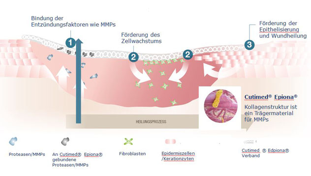 Die drei Schritte zur Wundheilung graphisch dargestellt