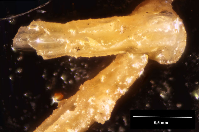Senckenberg, Bryozoa, Bryozoen, Moostierchen, Sammlung Voigt