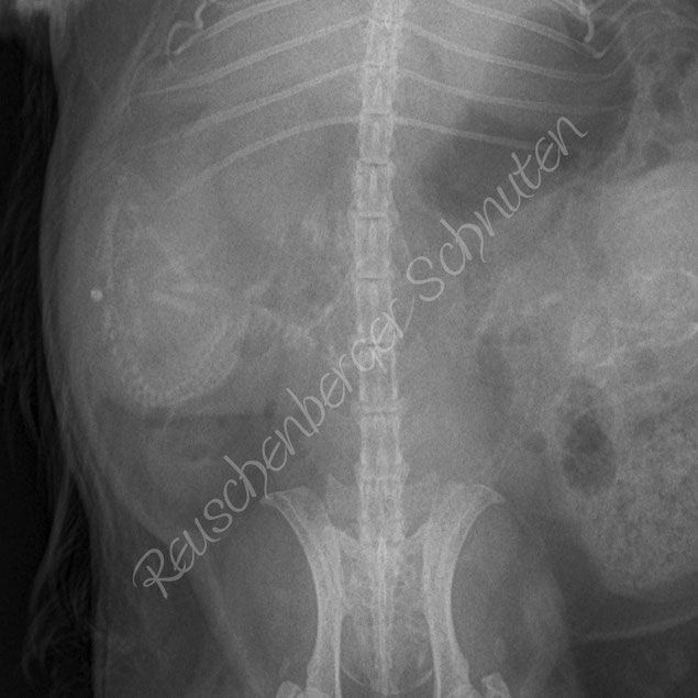 Gwilwileth hatte 5 Babies. Ihre Babies wurden vom Körper abgestoßen und es setze ein Abort ein. Nur mit Hilfe von Medikamenten ist es ihr gelungen die Babies wenigstens tot zu gebären und ihr Leben zu retten.