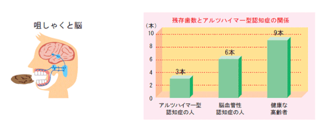 認知症