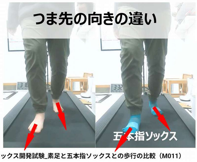 内くるぶし 下 痛い理由に答えます