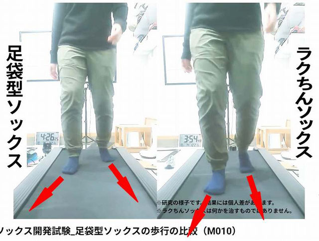 足底腱膜炎の原因と治し方