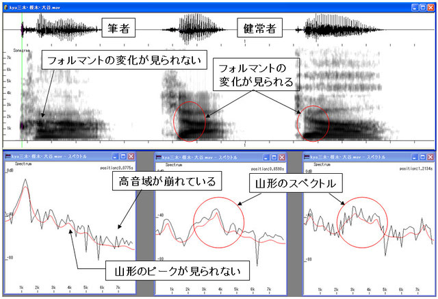 音声講座（第３部）障害音の音声分析