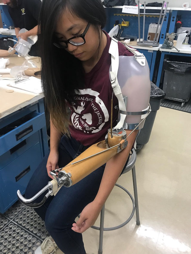 A passion for improved prosthetics  (picture courtesy of Daisy Luo)