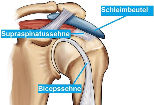 Wo Sitzt Der Schleimbeutel In Der Schulter www.ortho-clinic.ch