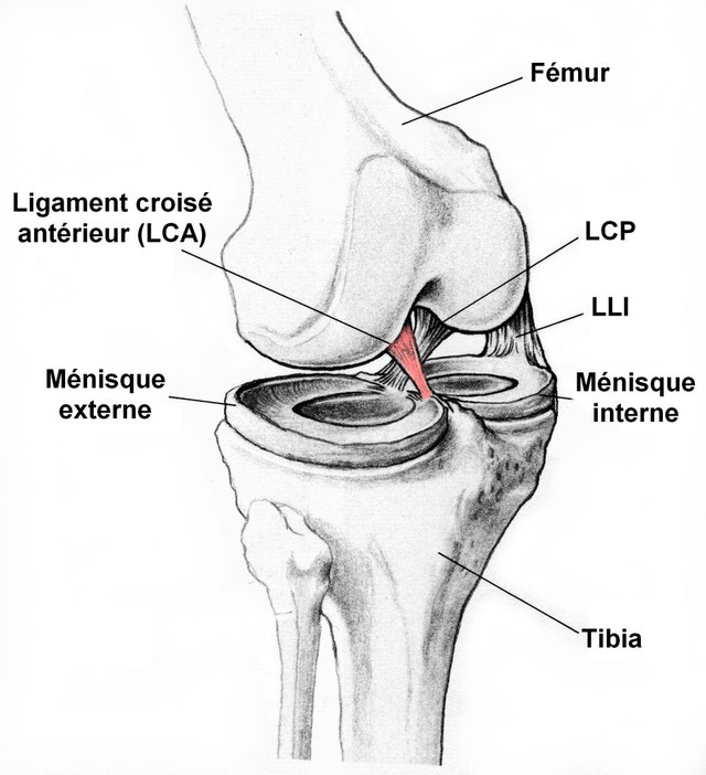 Lésions du ligament croisé antérieur Dr. Zanone Xavier, Chirurgie orthopédique, Genève
