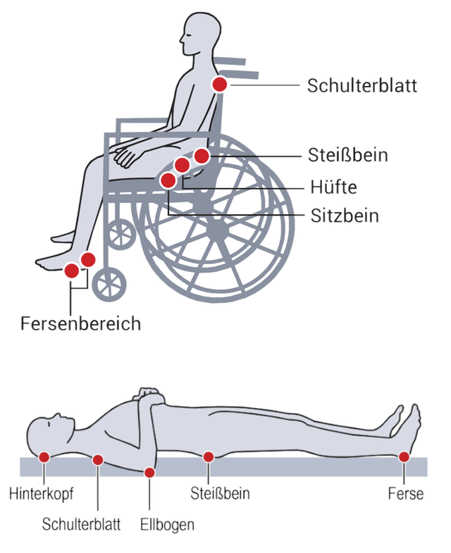 Antidekubitus - Sanitätshaus Manfred Klein GmbH & Co. KG