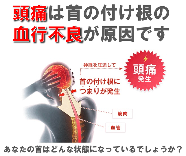 頭痛の原因。頭痛の治し方。整体で頭痛を治す。首こり頭痛。頭痛の原因は首にある。