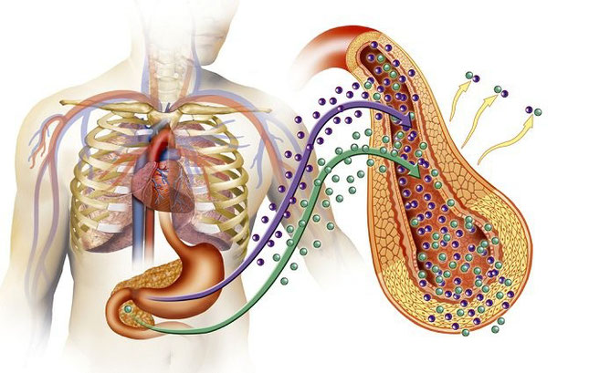 ¿Cómo saber si estás padeciendo prediabetes?