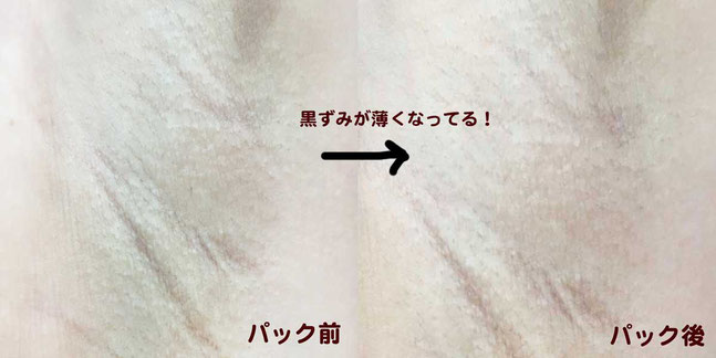 jusowakikuropack