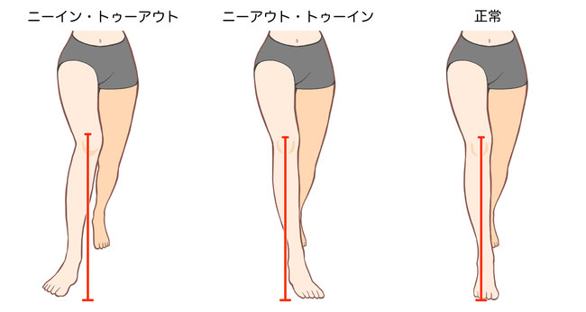 東京都葛飾区立石おすすめの本格整体,ひだまり整骨院膝の痛みイメージ画像