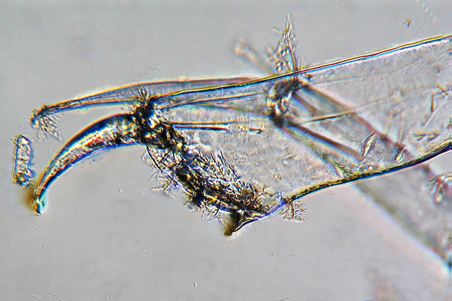 Sandgarnelenschere unter dem Mikroskop (Exuvie)