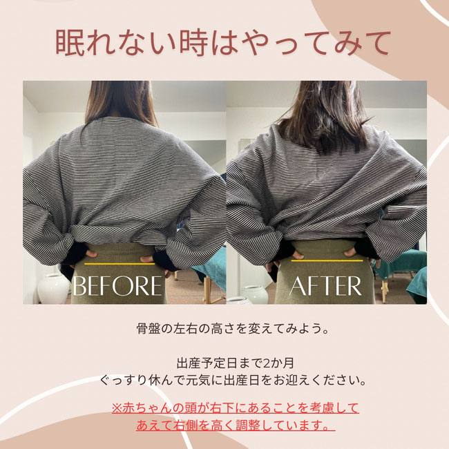 徳島のあおぞら整体院で徳島のあおぞら整体院で、妊娠した女性が眠れなくなり、当院の骨盤調整を受けてぐっすり眠れるようになったビジュアル。