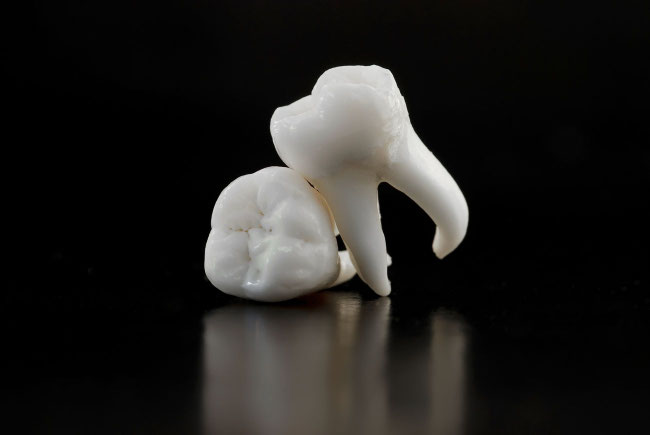 Oralchirurgische Behandlung – sanfte Zahn-Operation im Behandlungsraum der Zahnarztpraxis Dr. Jansen in Teufen