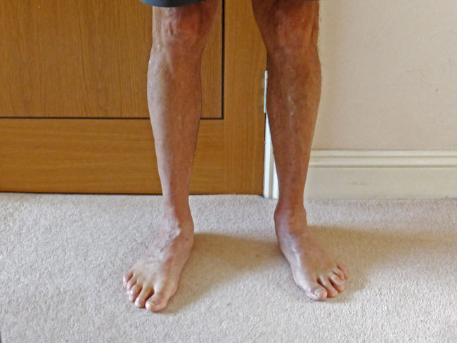 My legs, no flight socks