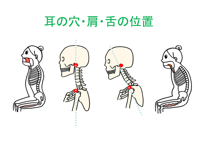 フォワードヘッドの改善