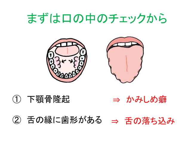 噛みしめのチェック