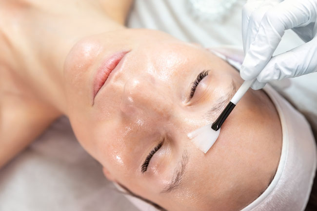 Fruchtsäurebehandlung Mesoppeling